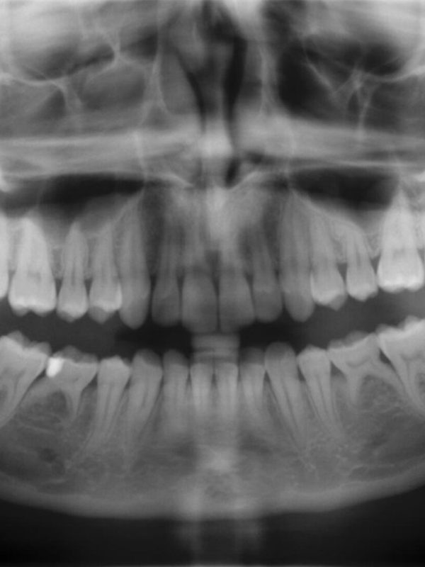 img-image-digital-dental-x-ray-large